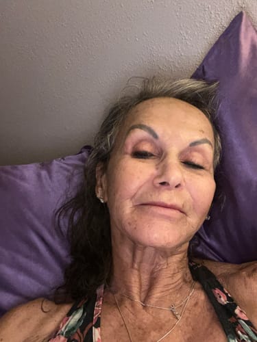 Customer's close-up of her face and neck after using Koriderm™ Time Reverse.