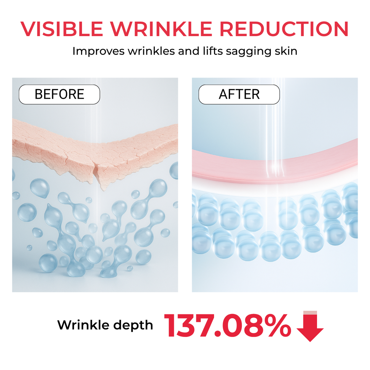 Before and after — skin elasticity restored