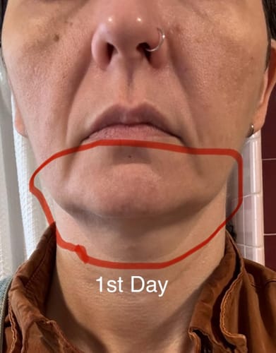 Customer photo review of Koriderm™ Time Reverse Neck Cream